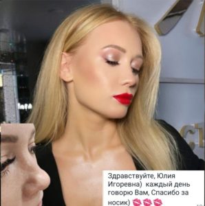 Риносептопластика