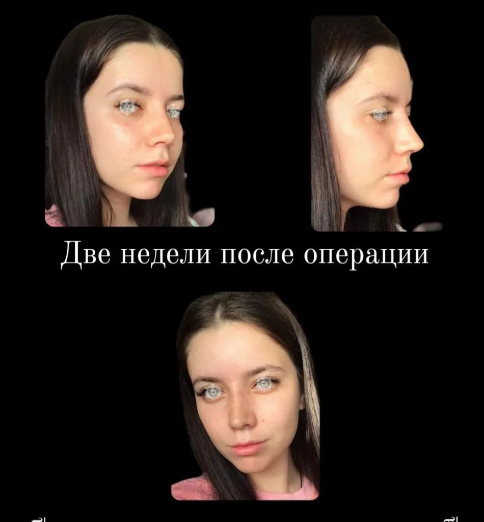 Отзыв пациента